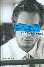 Pripad prilis svetlych oci